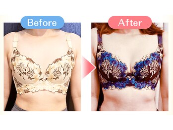 ヒーリング スポット/【Before＆After】