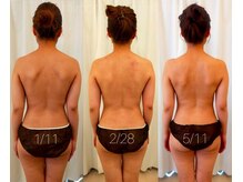 ミールーム(mi room)/痩身エステ４ヶ月