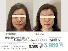 初回だけでもOK！しつこい勧誘無し！最短６回ではっきりわかる変化！