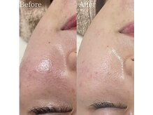 スリリアン 銀座/★お客さまビフォーアフター★