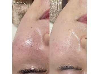 スリリアン 銀座/★お客さまビフォーアフター★