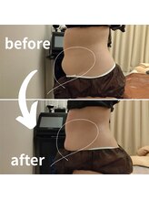 マールム(MALUM)/痩身70分コースでバランス痩せ！