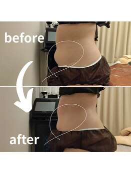 マールム(MALUM)/痩身70分コースでバランス痩せ！