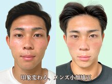 ナチュラルパーフェクトフェイス 新宿の雰囲気（メンズ小顔矯正,小じわやほうれい線にもアプローチ！[新宿/小顔]）