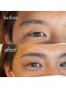【メンズ】眉毛ワックス脱毛