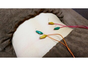 つつじが丘整骨院鍼灸マッサージ院/鍼灸×パルス電気