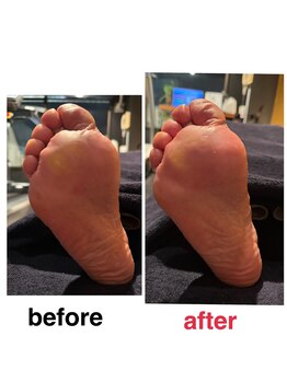 メディカルジャパン 吉祥寺/フットケアの効果