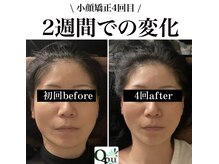 キュープ 富士店(Qpu)/スパンを詰めて通うと、、