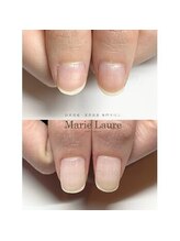 マリーロール 淀屋橋本店(Marie Laure)/深爪矯正/自爪育成/ネイルケア