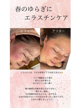 ムーン(MOON)/春のゆらぎにエラスチンケア