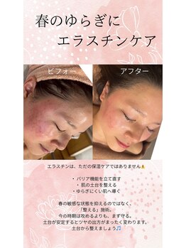 ムーン(MOON)/春のゆらぎにエラスチンケア