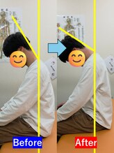 最後の整体 練馬駅前院/肩こりでお悩みの方の可動域