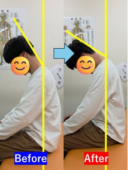 最後の整体 練馬駅前院/肩こりでお悩みの方の可動域