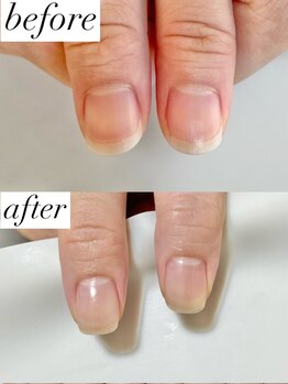 ニコワイズネイル(Nico Y's Nail)/【自爪育成コース】