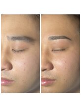 マグ 藤枝店(Mag)/２０代男性ビフォーアフター