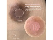 韓国で大人気のメラニン色素管理◎気になる黒ずみ全部ピンクに！