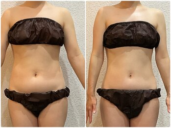 美容整体 ウェリナ 蟹江院/小顔矯正/骨盤矯正/美脚サロン