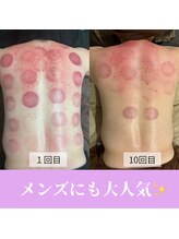 フリグス(Frigus)/【スライドカッピング】