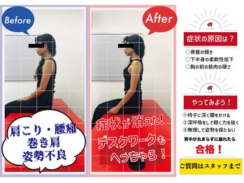 ナオル整体 山形院(NAORU整体)/Before→After