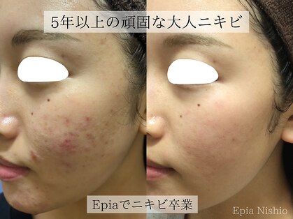 エピア 西尾店(Epia)の写真