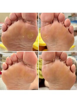 ドクターネイル爪革命 富山店/