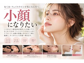 イチゲキ整骨院 新深江院の写真/小顔矯正でフェイスラインを整えませんか？顔のむくみたるみや二重あごをケアして輝く笑顔へ♪