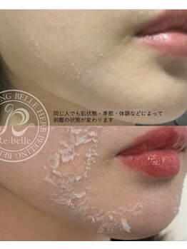 ベルシア ボディアンドアイラッシュ(Belsia)/【リベル】ハーブピーリング