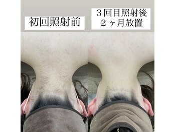 テンパ ビューティー(+10%beauty)/効果写真