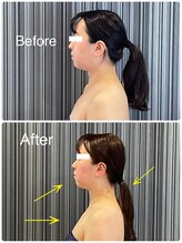 エクセレントビューティーサロン 艶(EN)/ブライダル　