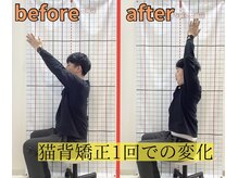 きずな鍼灸整骨院 武蔵ヶ丘本院/猫背矯正
