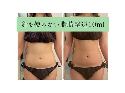 ソルニス(Solnis.)の写真