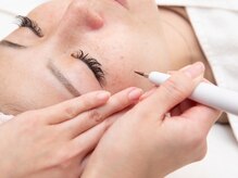 リンパクリニークアリスの雰囲気（気になるシミや隠れたシミも国産マシーンで丁寧にケア  シミケア）