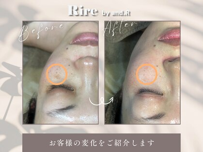 リル バイ アンドアール(Rire by and.R)の写真