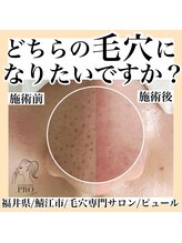 ピュール 鯖江店(PUR)/毛穴サロン/毛穴ケア/毛穴洗浄