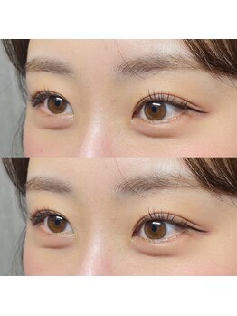 ヨーク トゥルペ(yorke tulpe)/ラッシュリフト/まつげパーマ