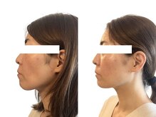 エニ(Eni)の雰囲気（即効性×持続力が自慢。今もこれからも変わらない美しさをご提供）