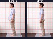 さいとう治療院 新百合ヶ丘/反り腰・骨盤のゆがみ