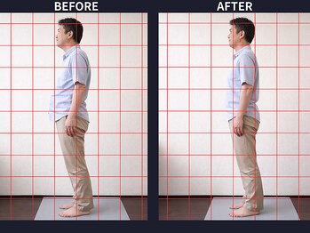 さいとう治療院 新百合ヶ丘/反り腰・骨盤のゆがみ