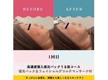 チアフル(Cheerful)の雰囲気（リフトアップ・細胞レベルでシミ・くすみを元のお肌に改善♪）