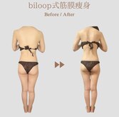 ビループ(biloop)