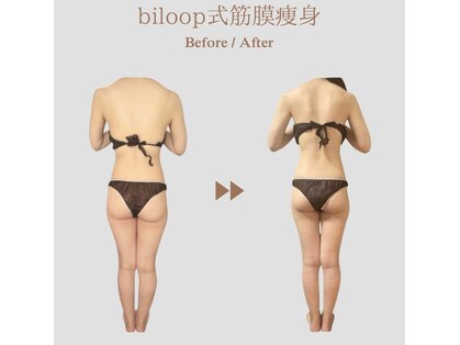 ビループ(biloop)の写真