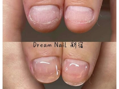 ドリームネイル 新宿(Dream Nail)の写真
