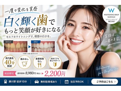 ホワイトニングショップ 春日井店(whitening shop)の写真