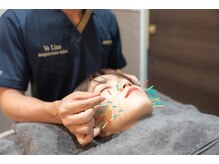 ヴィーライン 新横浜院(VeLine)/形状記憶美容鍼の施術