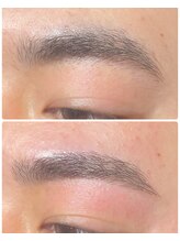 リコ(Lico)/メンズWAX脱毛