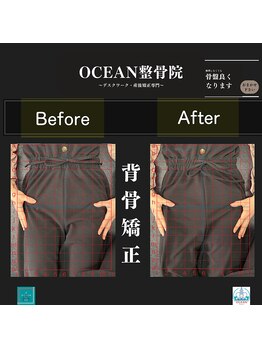 オーシャン整骨院(OCEAN整骨院)/背骨矯正ビフォーアフター