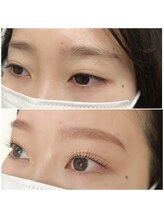 ビメ 中央林間(BEME)/before・after