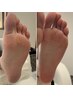 【フット】フットケア　6,600円