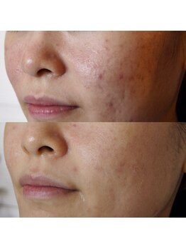 ザ シー タイムレスビューティ(THE SHE)/20代お客様症例写真