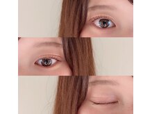 ウェヌス アイ ビューティ(VENUS eye beauty)